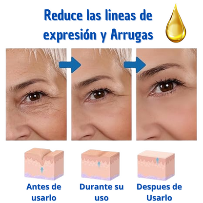 BOTOX SUERO ANTIEDAD